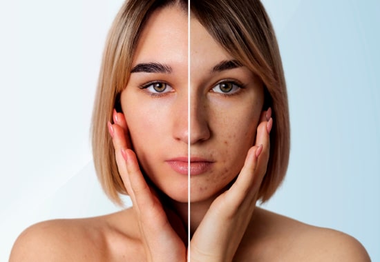 Skin Pigmentation, Skin Treatment, Skin Rejuvenation, Anti Ageing Skin Treatment, Skin Treatment, Face Lifting, Face Lifting Treatment, Face Lifting Without Surgery, Skin Polishing Treatment, Chemical Peel treatment in mumbai