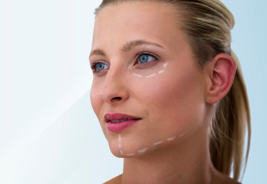 Face Lifting, Face Lifting Treatment, Face Lifting Without Surgery, Non Surgical Face Lifting