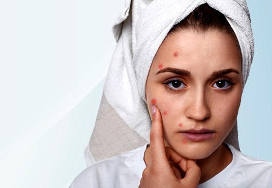 Pimples, Scars, blackheads, whiteheads treatment clinics, centers in mumbai